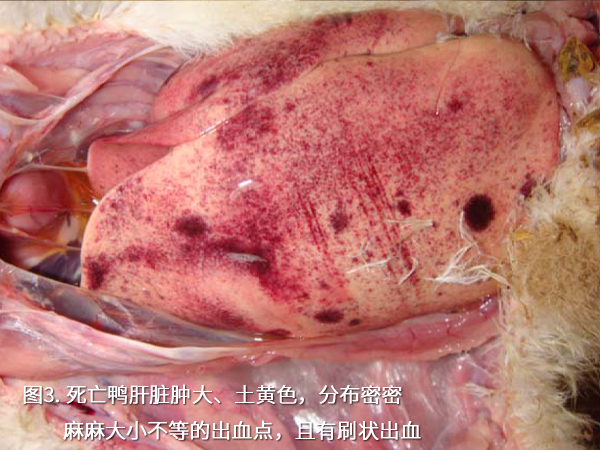 死亡鴨肝臟腫大、土黃色，分布密密麻麻大小不等的出血點(diǎn)，且有刷狀出血